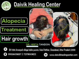 Best hair growth treatment is provided at Divine Healing Center in Ghaziabad, Uttar Pradesh.