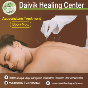 acupuncture treatment in Indirapuram