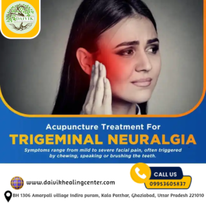 Acupuncture treatment for Trigeminal Neuralgia