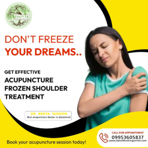 Get Effective Acupuncture Frozen Shoulder Treatment.