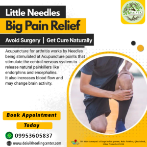 Little Needles Big Pain Relief Avoid Surgery Get Cure Naturally