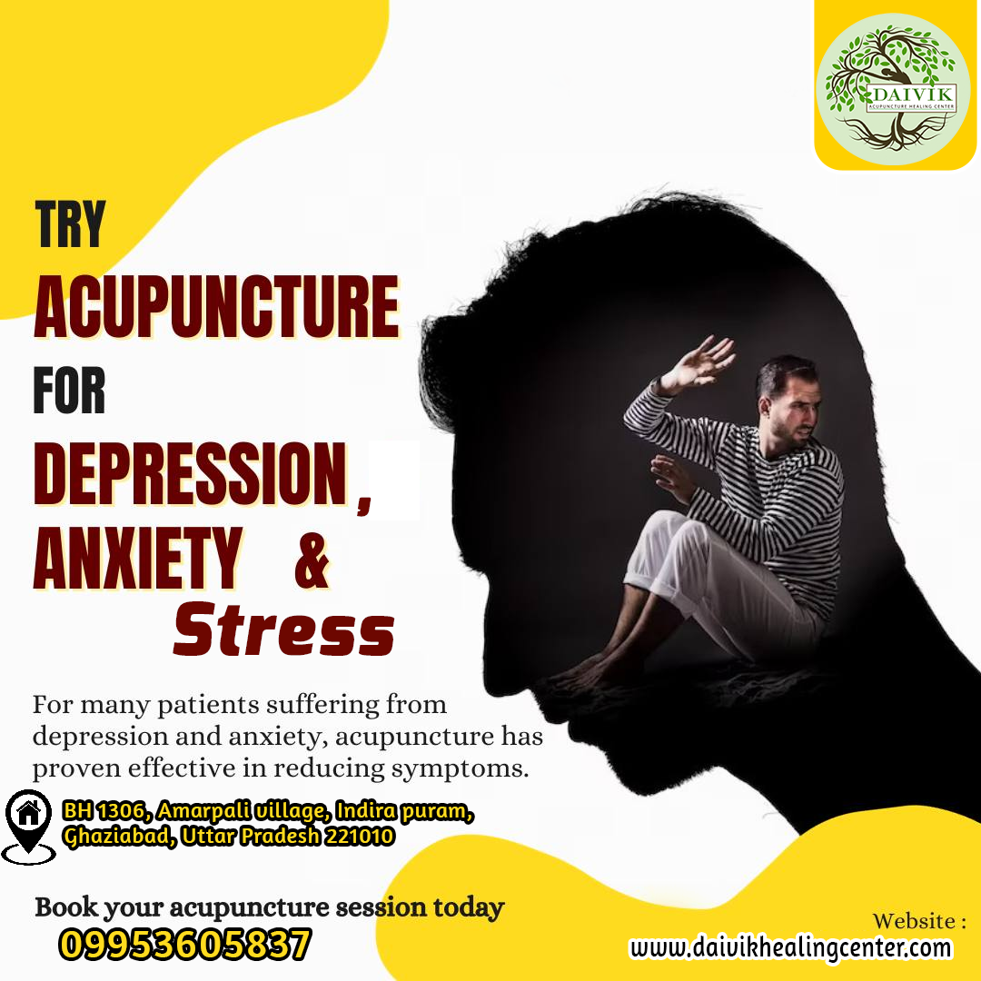 Try Acupuncture for depression, anxiety & Stress.