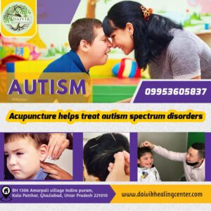 Acupuncture help treat autism spectrum disorder.