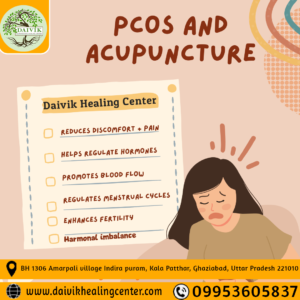 Acupuncture for PCOS Treatment in Indirapuram Ghaziabad.